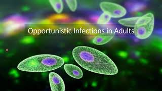 Opportunistic Infections Objective 4 [upl. by Naul992]