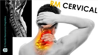 ¿Cómo se hace una Resonancia Magnética de columna Cervical en Resonancia Abierta y Cerrada telde [upl. by Ahsakat390]