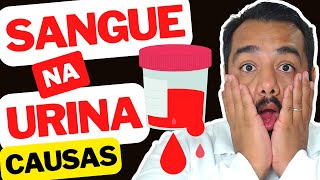 Urina Com Sangue Hematúria Entenda as Causas  Xixi Vermelho ou Rosa  Exame de Urina [upl. by Afatsuom269]