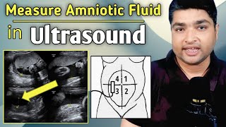 How to measure amniotic fluid index by ultrasound  Amniotic fluid level chart during pregnancy [upl. by Inobe]