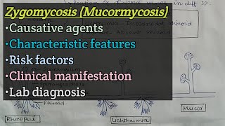 Zygomycosis Mucormycosis  Agents  Risk factors  Clinical manifestation  Lab diagnosis [upl. by Spence843]