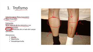 Semiologia del sistema nervioso [upl. by Eimyaj]