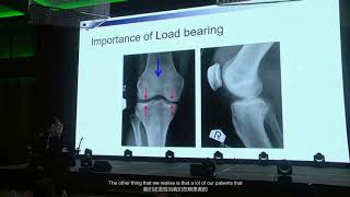 Application of Stem Cells in Orthopaedic Surgery Dr Khay Yong Saw subtitled [upl. by Sigler]