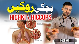 Hichki Kaise Band Kare  Hiccups Treatment in UrduHindi [upl. by Zora]