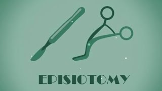 topic episiotomy  gnm anm bsc nursing [upl. by Enylrac]