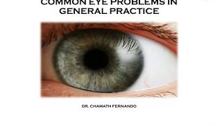 Common Eye Conditions Dr Chamath Fernando [upl. by Llacam]