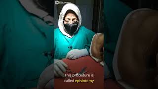 Episiotomy sciessor Part1 doctor delivery hospital nursingexperts pregnancy nursingstudents [upl. by Anegal]