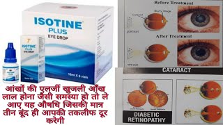 ISOTINE PLUS EYE DROP ।। Eye tonic for complex family आयुर्वेदिक आई टॉनिक [upl. by Dunc864]