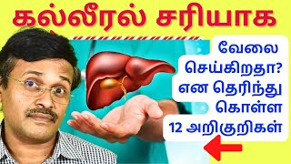 கல்லீரல் பாதிப்பை காட்டும் 12 அறிகுறிகள்  12 signs of liver damage [upl. by Aicina]