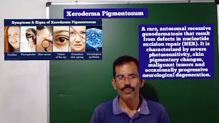 XERODERMA PIGMENTOSUM SAM BIOLOGY 🧫 CLASS [upl. by Sheepshanks]