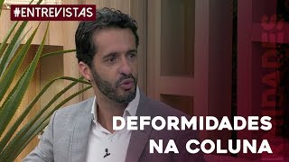 Tire suas dúvidas sobre deformidades na coluna [upl. by Oran]