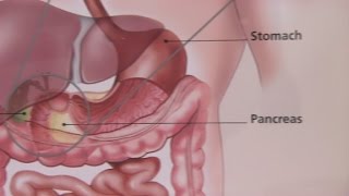 Irritable Bowel Syndrome amp Its Symptoms [upl. by Eanram]