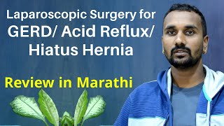 Longterm Acid refluxHiatus HerniaHeartburn treatment in Ahmedabad Patient Review In Marathi [upl. by Crescentia833]