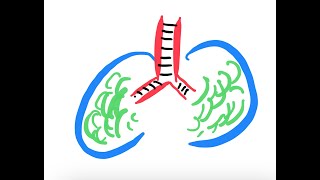 Noncardiogenic pulmonary edema [upl. by Amalburga]