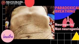 Paradoxical breathing pattern  Diaphragmatic paradox paradoxicalrespiration diaphragmaticpalsy [upl. by Einotna]