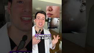 Congested Skin Derm explains [upl. by Lammond]