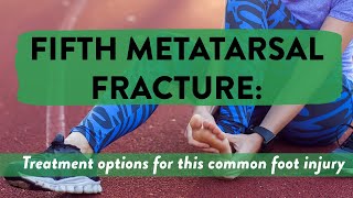 Fifth metatarsal fracture Treatment options for this common foot injury [upl. by Massimiliano]