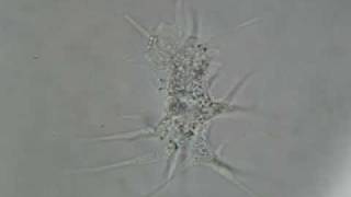 Amoeba under microscope III [upl. by Hsakaa]