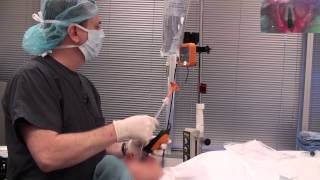 Video Laryngoscope stylet intubation [upl. by Einahpad]