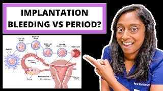 IMPLANTATION BLEEDING VS PERIOD HOW TO TELL THE DIFFERENCE [upl. by Publius302]