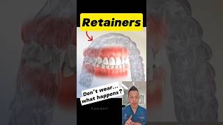 The Truth About Retainers Why You Should Never Skip Them dentallan dentist shorts [upl. by Nolita]