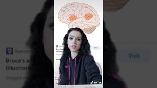 Brocas amp Wernickes Aphasia simple explanation [upl. by Crista]