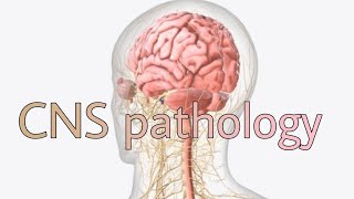 CNS pathology 2nd lecture [upl. by Rubma873]