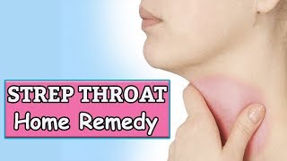 How To get Rid Of Strep Throat Without Antibiotics  Home Remedies For Strep Throat [upl. by Unni]