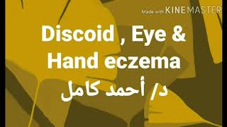 Discoid  Eye amp Hand eczema [upl. by Rora]