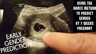 EARLY GENDER PREDICTION  RAMZI METHOD  7 WEEKS PREGNANT [upl. by Ahsuat146]