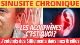 Jentends des Sifflements dans mes Oreilles Acouphènes Que faire Voici Comment sen Débarrasser [upl. by Etnaled707]