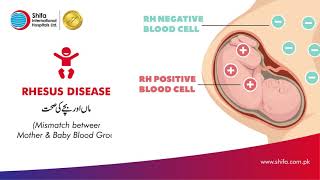 What is Rhesus Disease amp How it affects your baby  Interview with Dr Yasser Masood [upl. by Norrabal]