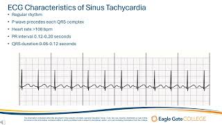 Sinus Tachycardia [upl. by Epp828]