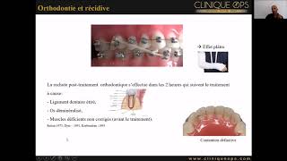 Partie 12  Le traitement Orthodontique nest pas efficace longtemps Préjugé ou vérité [upl. by Corine]