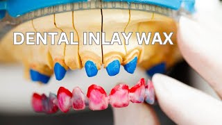 Classification of Dental Wax  Inlay  Baseplate  Casting Wax [upl. by Adigun982]