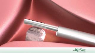 MyoSure Procedure Animation [upl. by Sang]