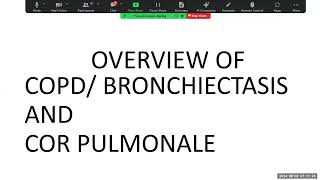 practice questions on bronchiectasis and lupus nephritis [upl. by Dasi]