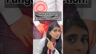 Fungal infection on skin  Ointment for fungal infection  Fungal infection in private parts [upl. by Adley685]