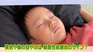 【公式】「黄色や緑の目やには 細菌性結膜炎のサイン？」（10月29日放送）｜テレビ西日本 [upl. by Nnylaehs700]