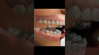 Jaw Treatment teeth dentist health [upl. by Chadbourne]