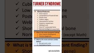 Turner syndrome  viralvideo turnersyndrome chromosome [upl. by Whitver]