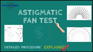 Astigmatic Fan Test Detailed Procedure and Principle Explained [upl. by Wil29]