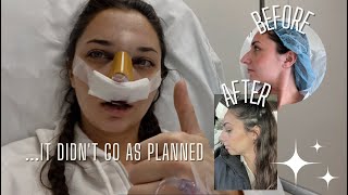 I got a nose job in secret and vlogged the process [upl. by Ordnassela797]