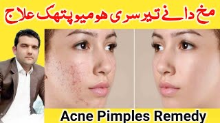 Acne Pimples Treatment in Pashto Language  wrinkles freckles remedy in pashto language  pukhto [upl. by Cindy645]