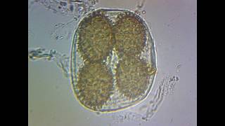 Tuber Brumale spores identification wild truffle [upl. by Occer]