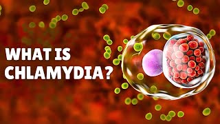 Chlamydia STI – Causes Signs and Symptoms Diagnosis amp Treatment [upl. by Dotti510]