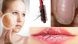 ¿Pierdes el cabello ¿Tienes la piel seca ¡Descubre qué VITAMINA te hace falta [upl. by Lesig238]