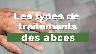 Les types de traitements des abces [upl. by Iznyl]