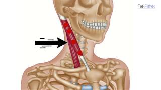 How To Find Trigger Points  Sternocleidomastoid Head and Ear Pain [upl. by Anerbas69]