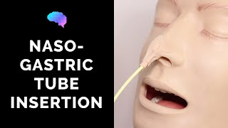 Nasogastric NG Tube Insertion  OSCE Guide  UKMLA  CPSA [upl. by Naujtna95]